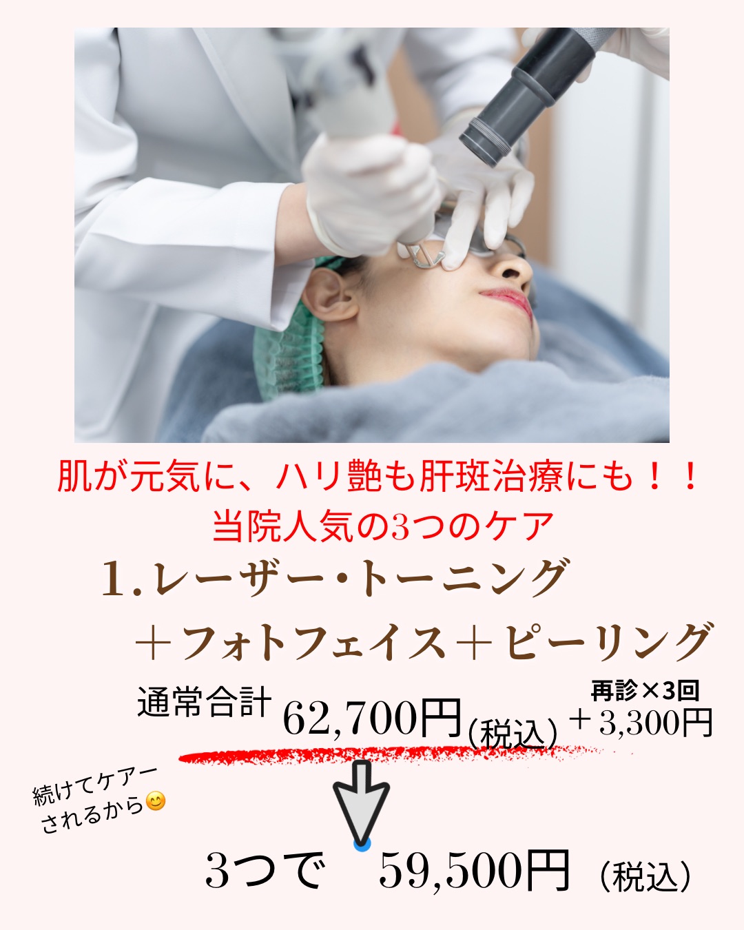 レーザートーニング＋フォトフェイス＋ピーリング